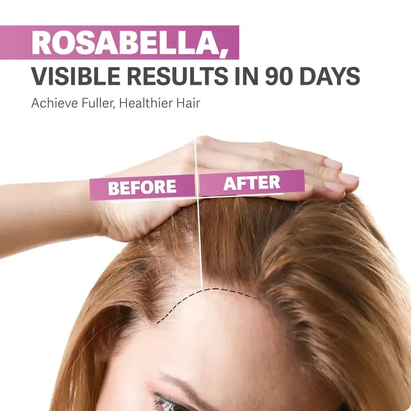⚡️LAST DAY - 50% Off⚡️Biotin Gummies for Hair, Skin & Nails Growth-HHC8