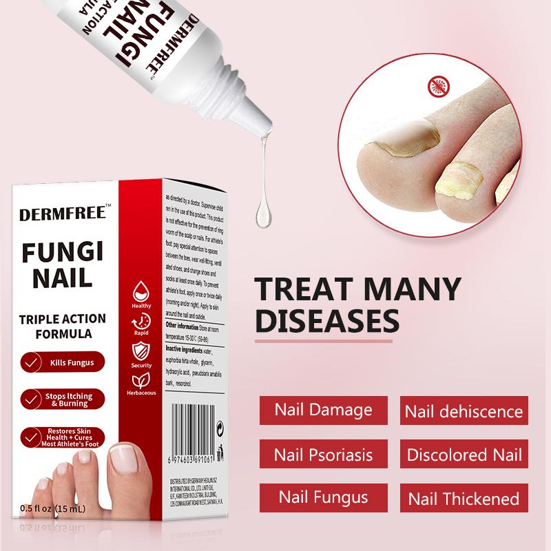 💜 LAST DAY PROMOTION - 50%OFF💜Toenail Fungus Treatment Extra Strength-TTA6