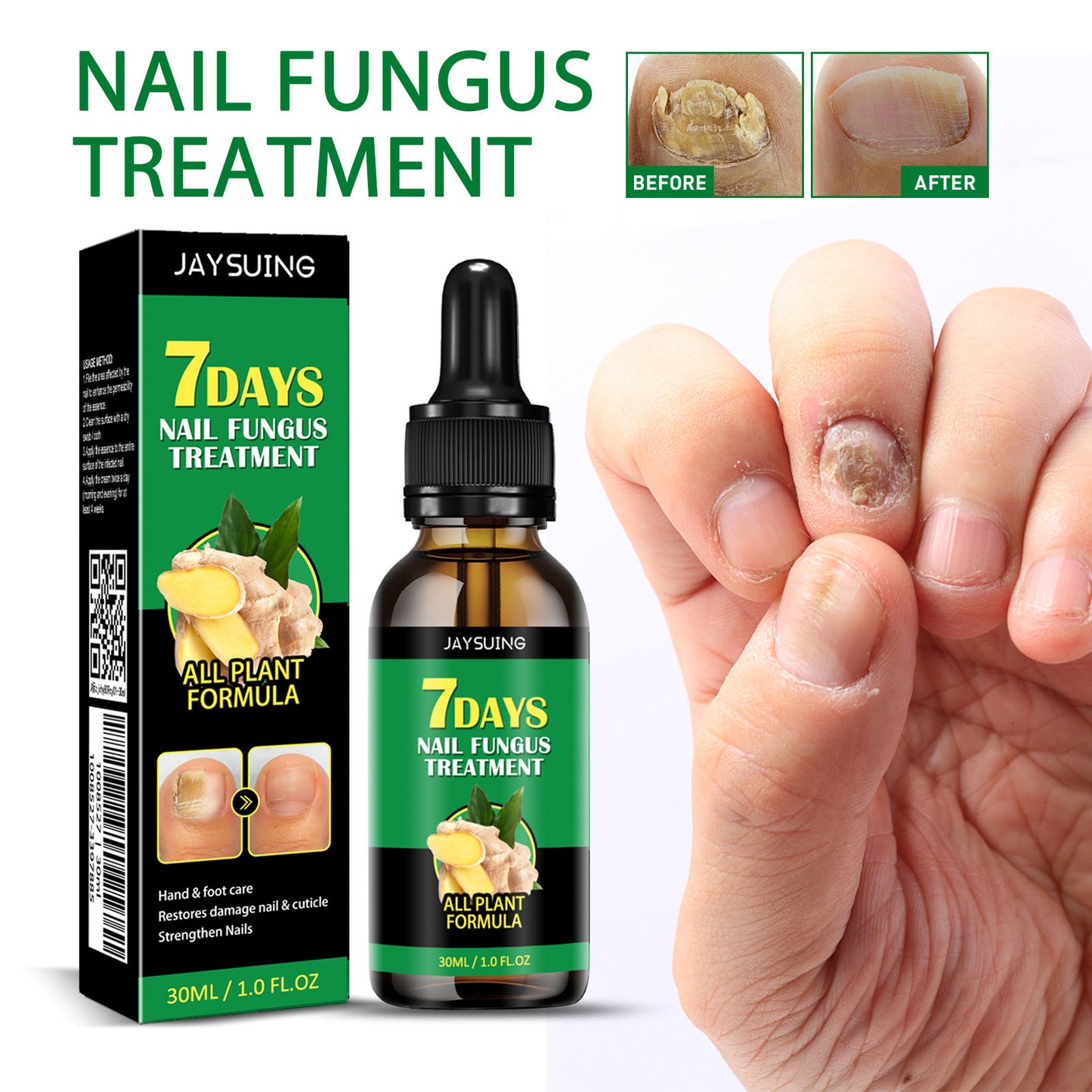 🏆Flash Sale⚡ 50K+ SOLD! Almost Gone-💥Nail Fungus - JSS6