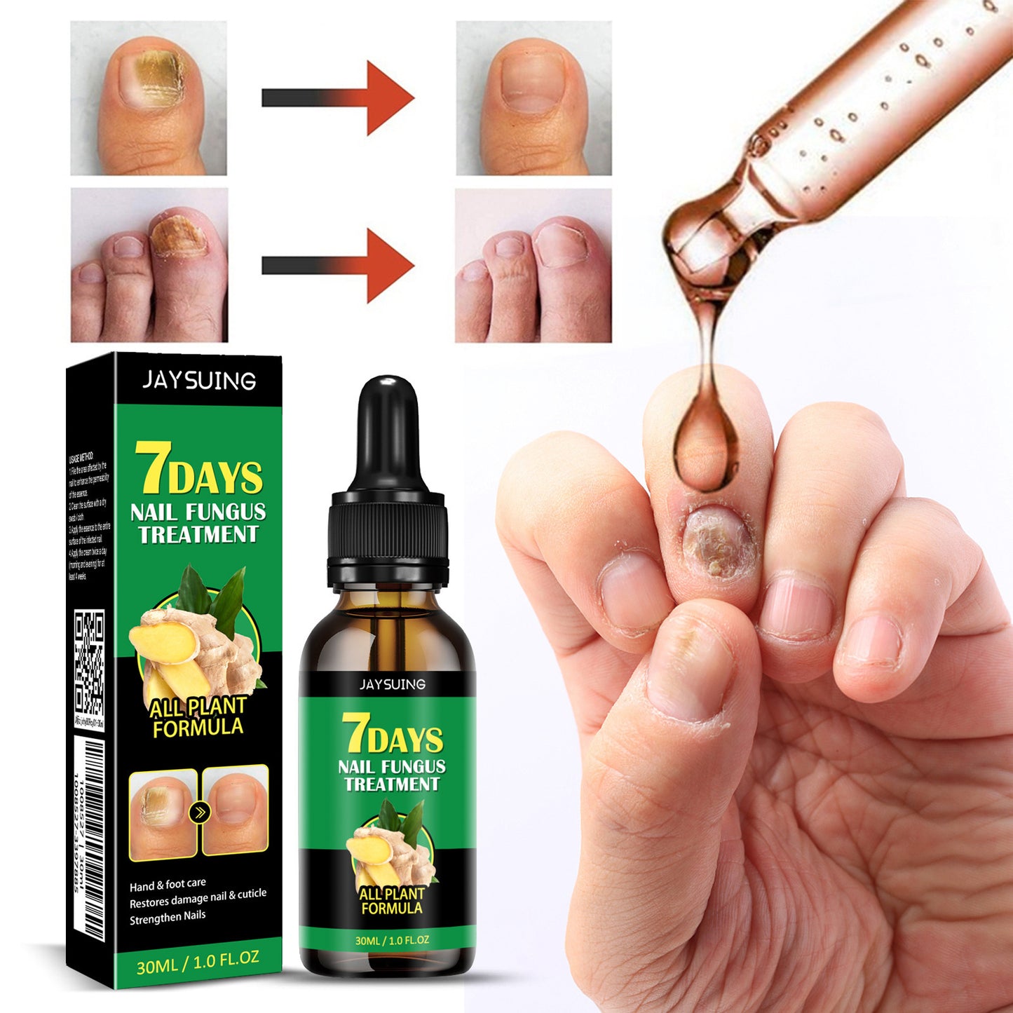 🏆Flash Sale⚡ 50K+ SOLD! Almost Gone-💥Nail Fungus - JSS6