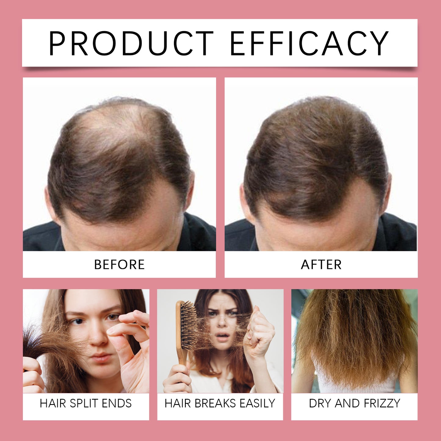 🏆Flash Sale⚡ 50K+ SOLD! Almost Gone-💥 Advanced Hair Growth Spray - JSS6