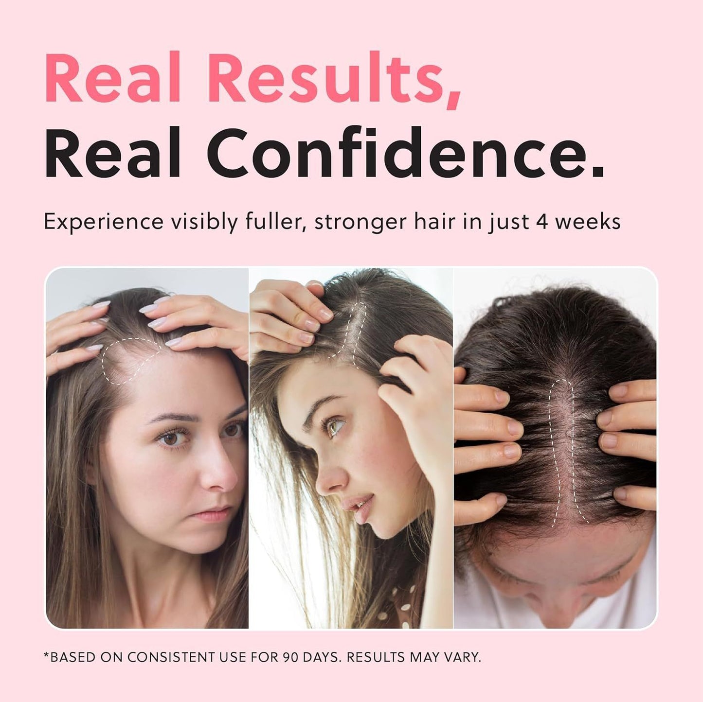 🏆Flash Sale⚡ 50K+ SOLD! Almost Gone-💥 Advanced Hair Growth Spray - JSS6