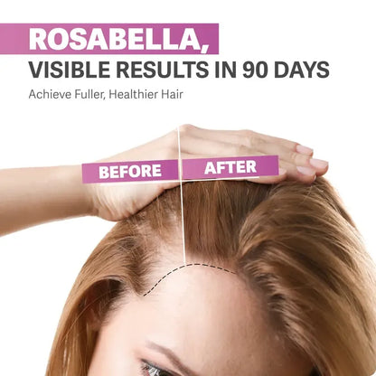 ⚡️LAST DAY - 50% Off⚡️Biotin Gummies for Hair, Skin & Nails Growth-HHC8