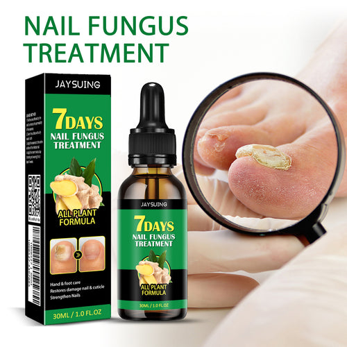 🏆Flash Sale⚡ 50K+ SOLD! Almost Gone-💥Nail Fungus - JSS6