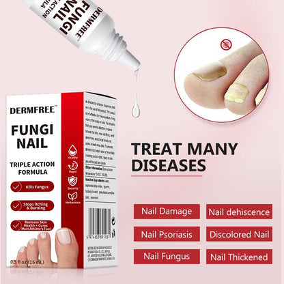 💜 LAST DAY PROMOTION - 50%OFF💜Toenail Fungus Treatment Extra Strength-TTA6