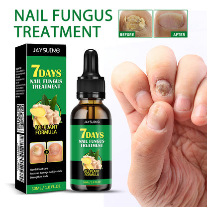 🏆Flash Sale⚡ 50K+ SOLD! Almost Gone-💥Nail Fungus - JSS6