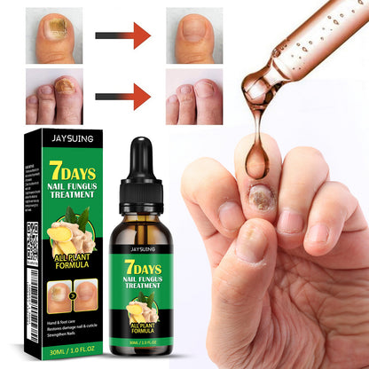 🏆Flash Sale⚡ 50K+ SOLD! Almost Gone-💥Nail Fungus - JSS6