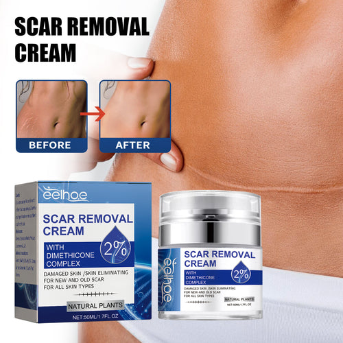 💥Brand-new upgraded version💥Silicone Scar Repair Cream-ABB8