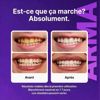 60% DE RÉDUCTION DERNIER JOUR ! - VERVEBEAD Purple Teeth Whitening Strips™ - A926